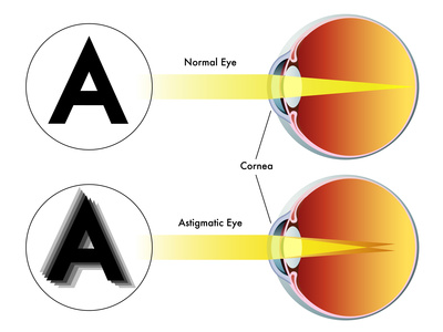 Faa Medical Eye Chart